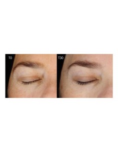 VOLUMI-LOOK SkinClinic 2